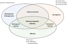 Osteo-Sarcobesity