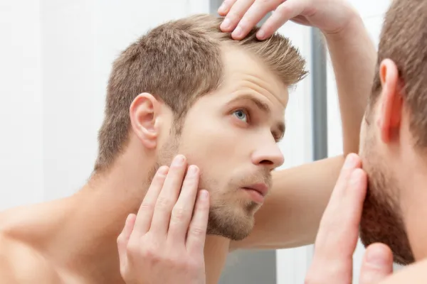 photo of man with hair loss