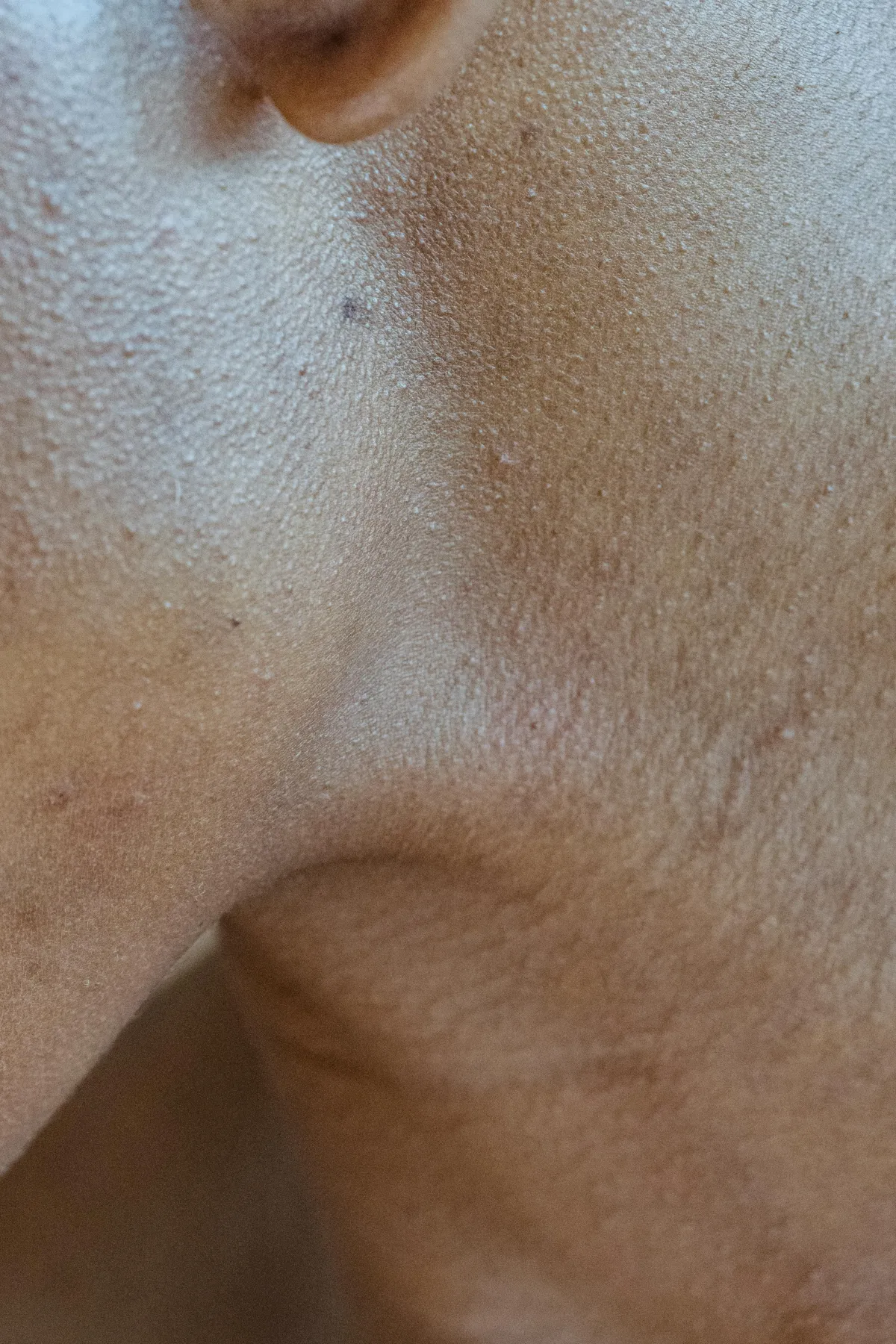 Neck