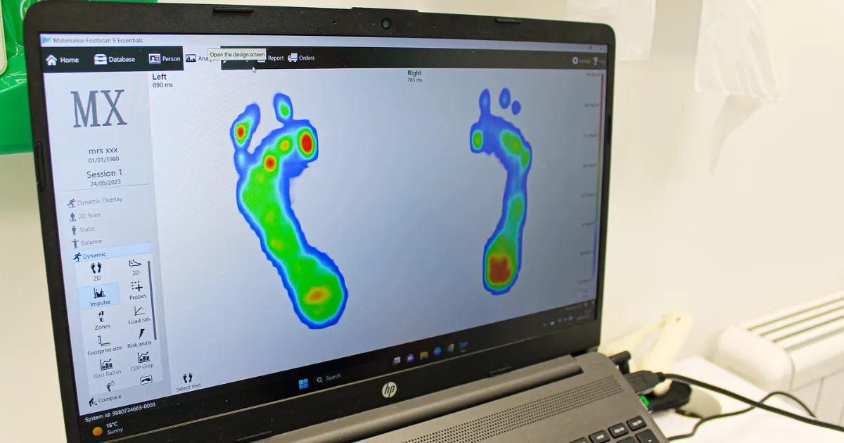 Diabetic Foot Care: How 3D Footscan Technology Prevents Complications | Kenilworth Footcare