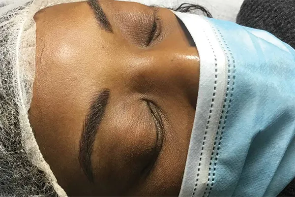 Microblading on Dark Skin | Beauti4Skin Medspa n Laser