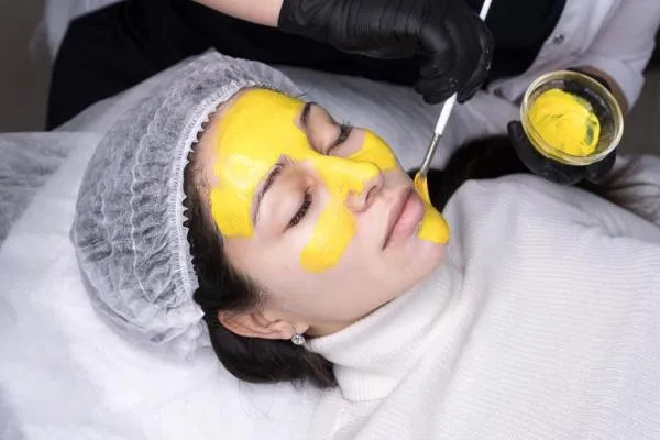 Facials Peels