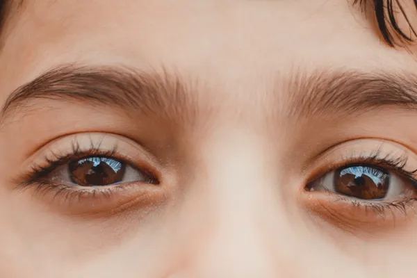 Eyes