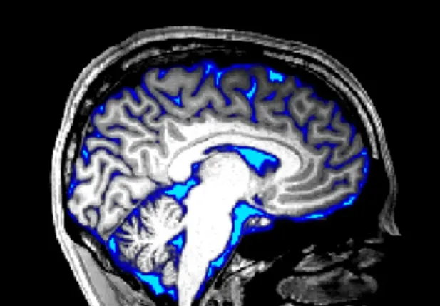 brain connections