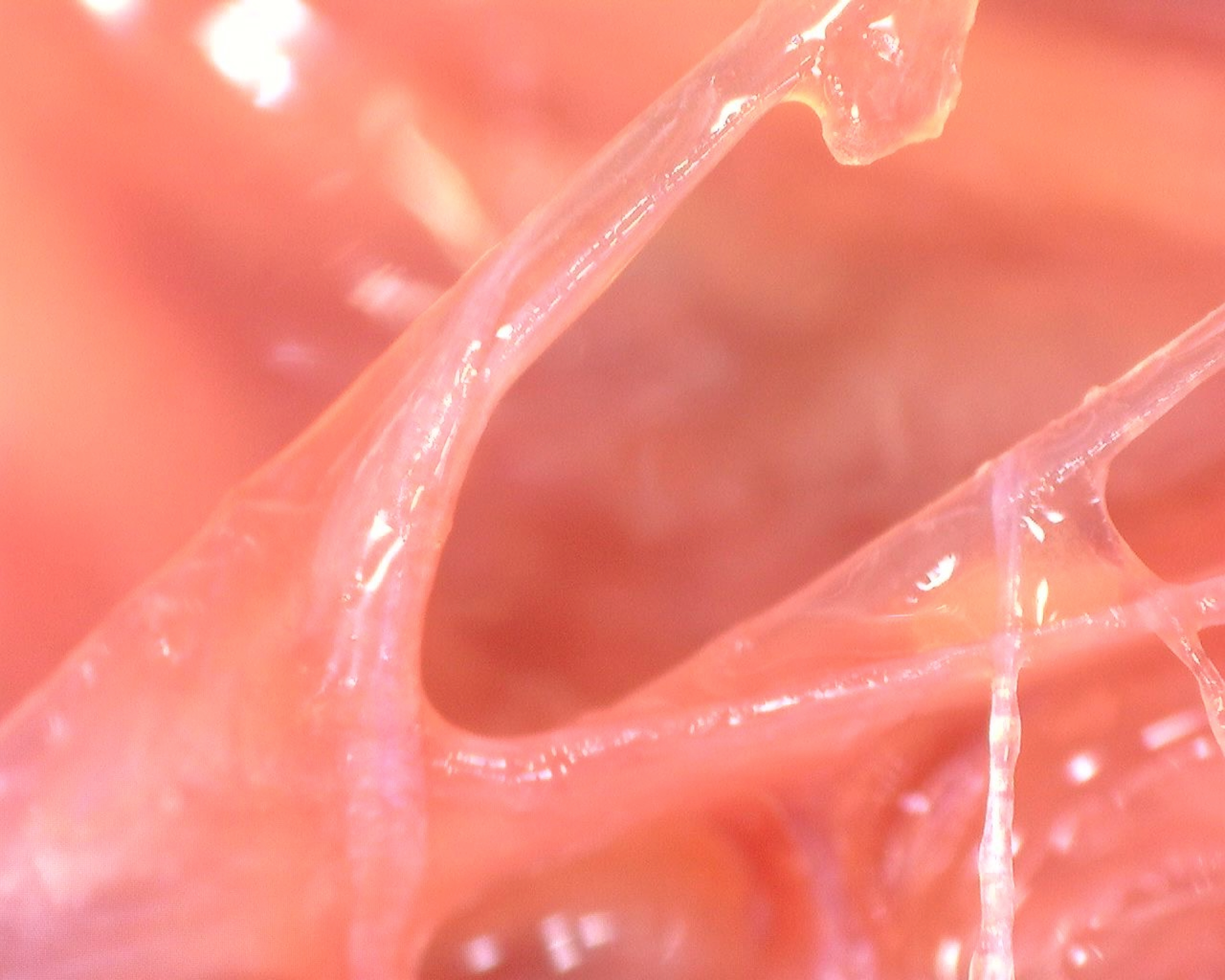 Fascia: The thread between science and story 