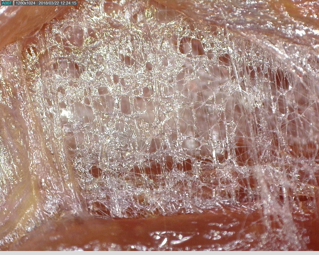 fascial fibres under microscope