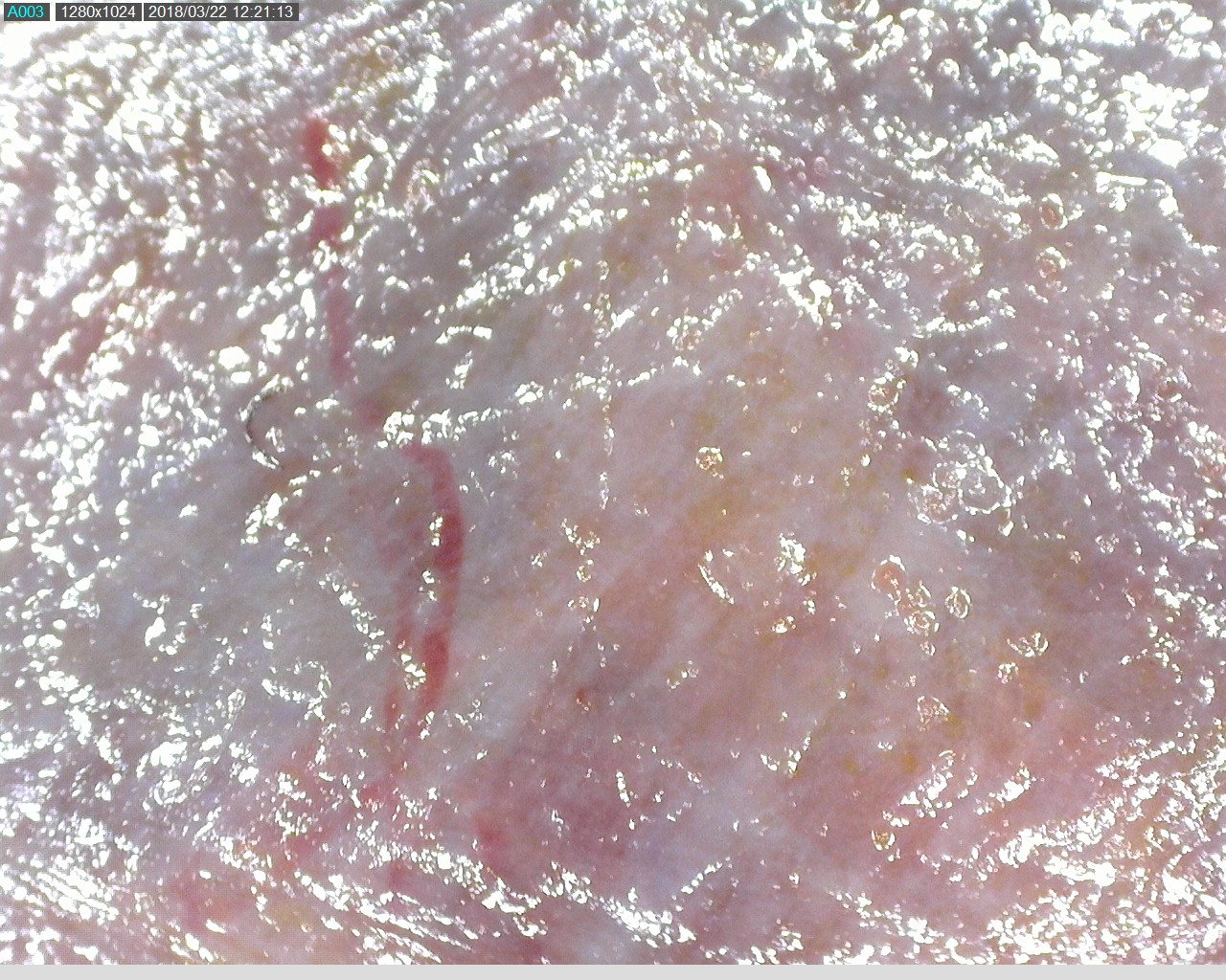 fascia sheet seen under microscope with blood vessel visible
