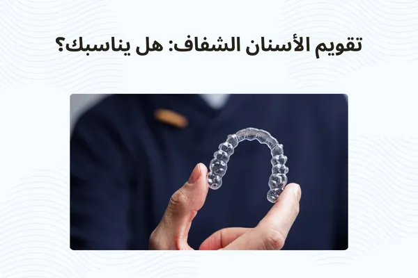 تقويم الأسنان الشفاف: هل يناسبك؟
