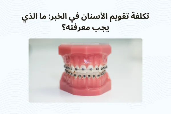 تكلفة تقويم الأسنان في الخبر: ما الذي يجب معرفته؟