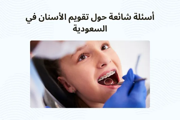 أسئلة شائعة حول تقويم الأسنان في السعودية