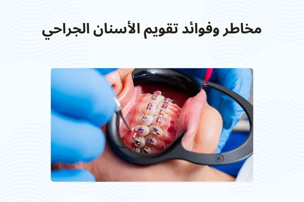 مخاطر وفوائد تقويم الأسنان الجراحي