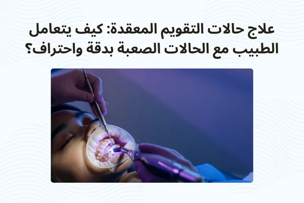 علاج حالات تقويم الأسنان المعقدة باستخدام تقنيات حديثة