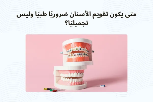 متى يكون تقويم الأسنان ضروريًا طبيًا وليس تجميليًا؟