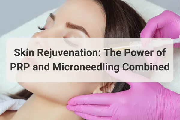 Before and after results of combined PRP and microneedling skin rejuvenation treatment at Knightsbridge Advanced Beauty showing dramatic collagen stimulation