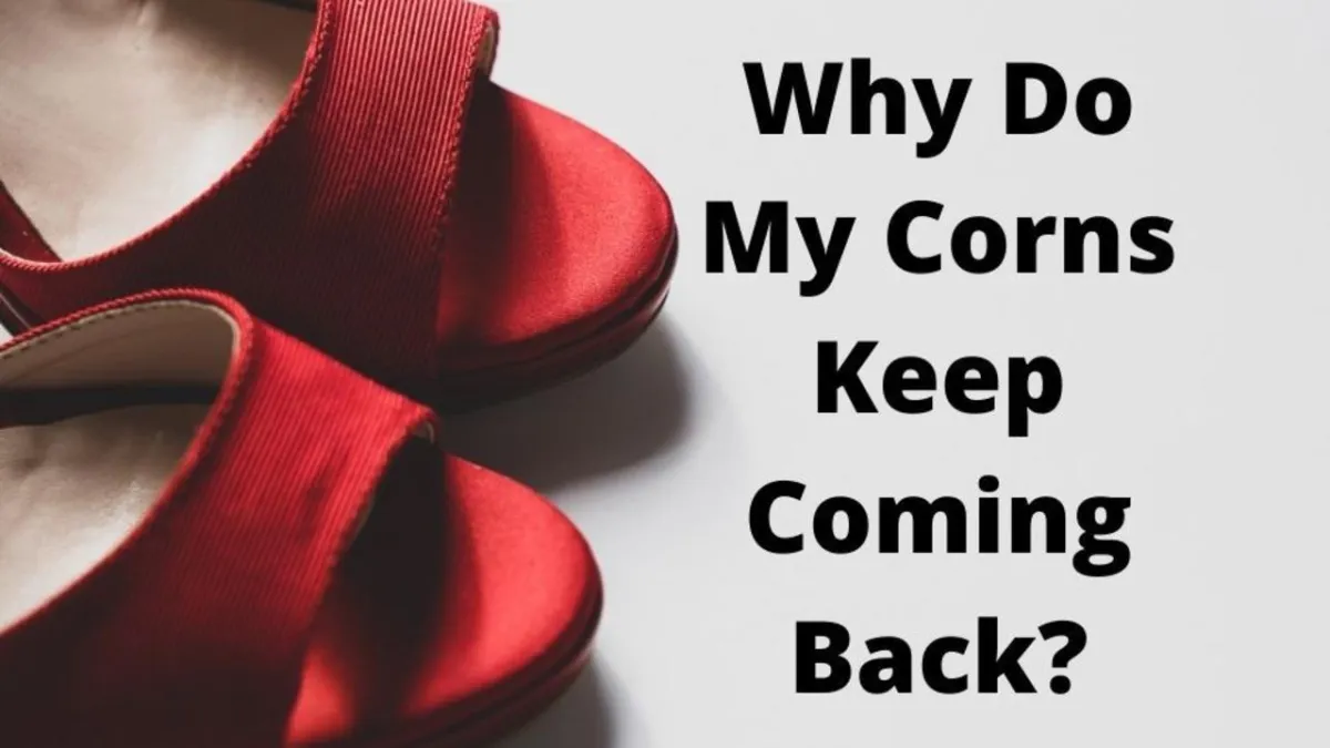 Why Do My Corns Keep Coming Back?
