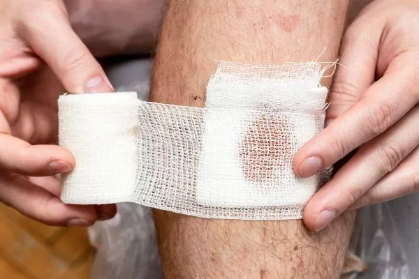 wound care blog post cover