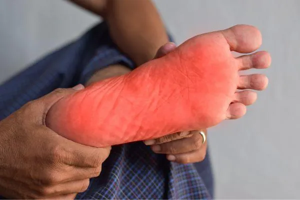 plantar fasciitis pain