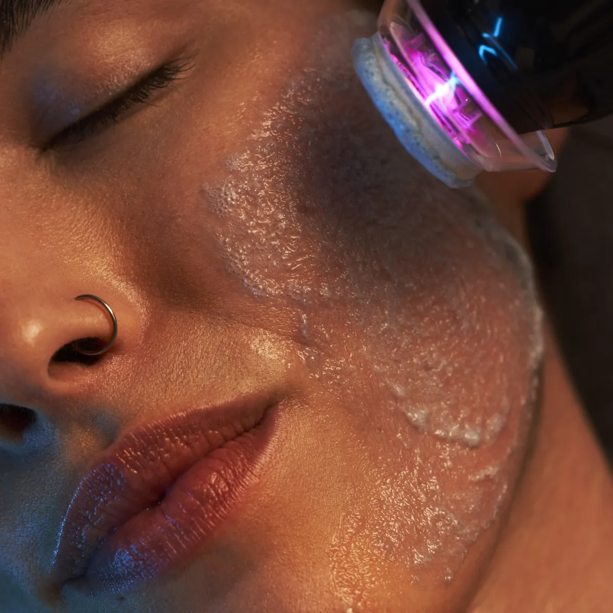 Key Benefits of Glo2Facial