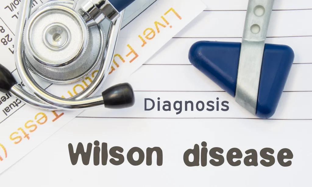 The Use Of Bioresonance Therapy In The Treatment Of Wilson Disease