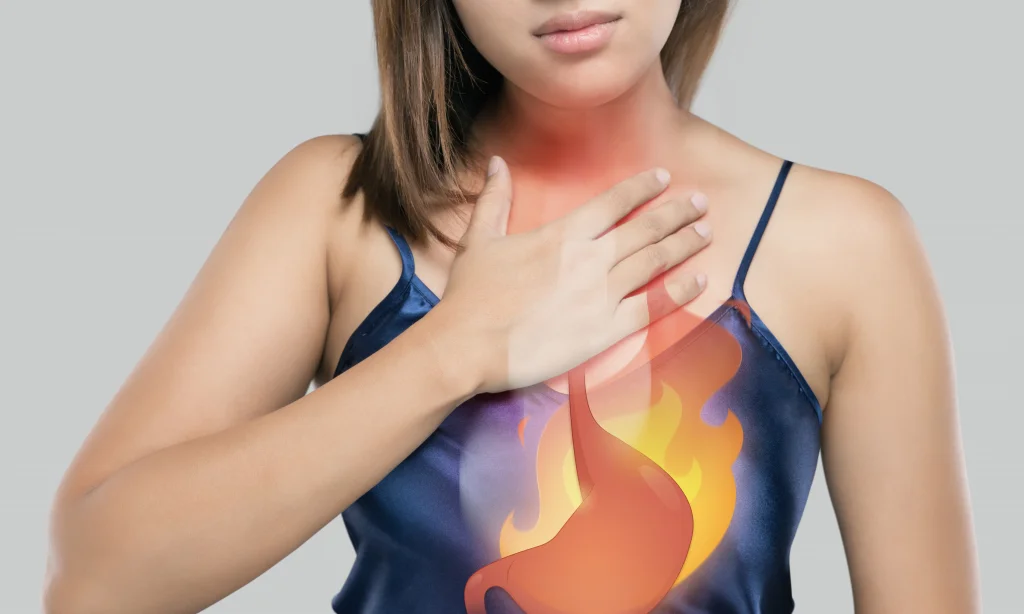 Can You Treat Your Heartburn with the Use of Bioresonance?