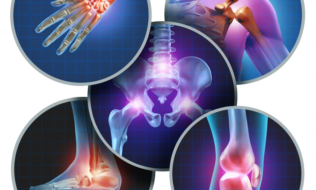 Alpha-Stim Therapy In The Treatment Of Pain Symptoms