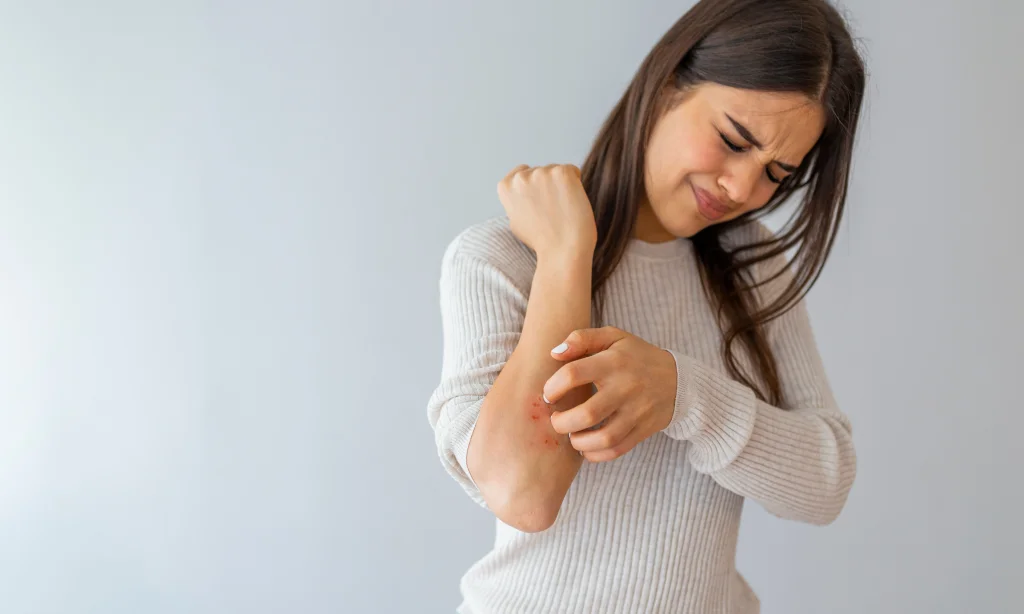 Is It Possible to Treat Your Psoriasis by Using the Concepts of Bioresonance?