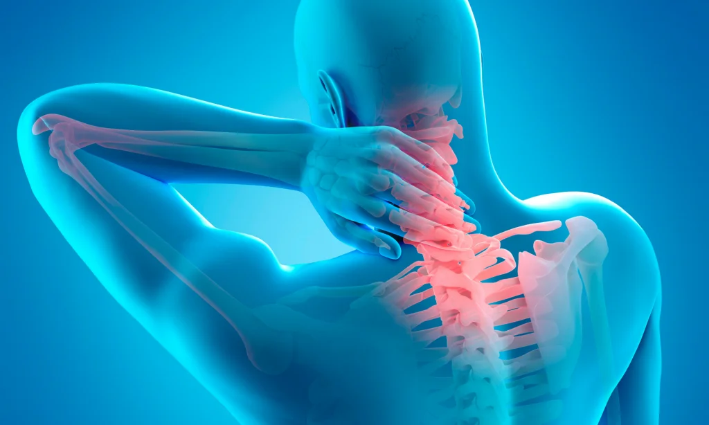 Bioresonance Therapy For Neck Pain