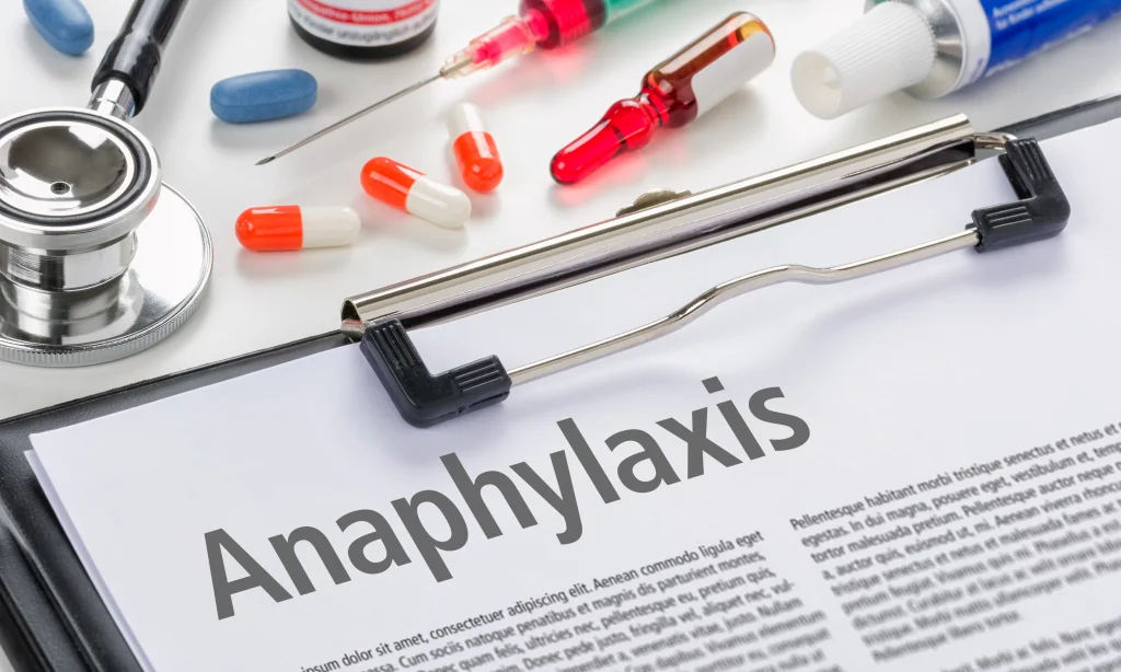 Bioresonance And Anaphylactic Shock