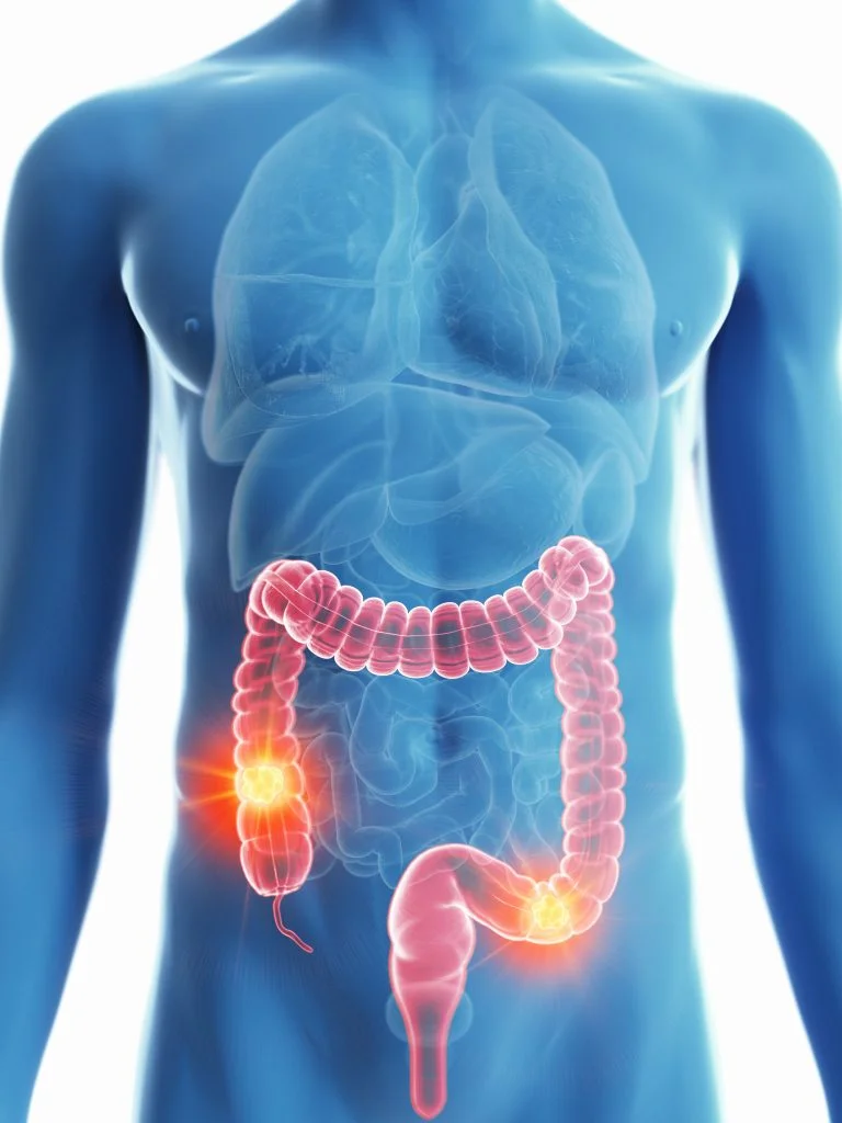50% of All Colon Cancer Cases Could Be Prevented If Everybody Did THESE 9 Things