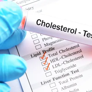 Can Bioresonance Treat Cholesterol?