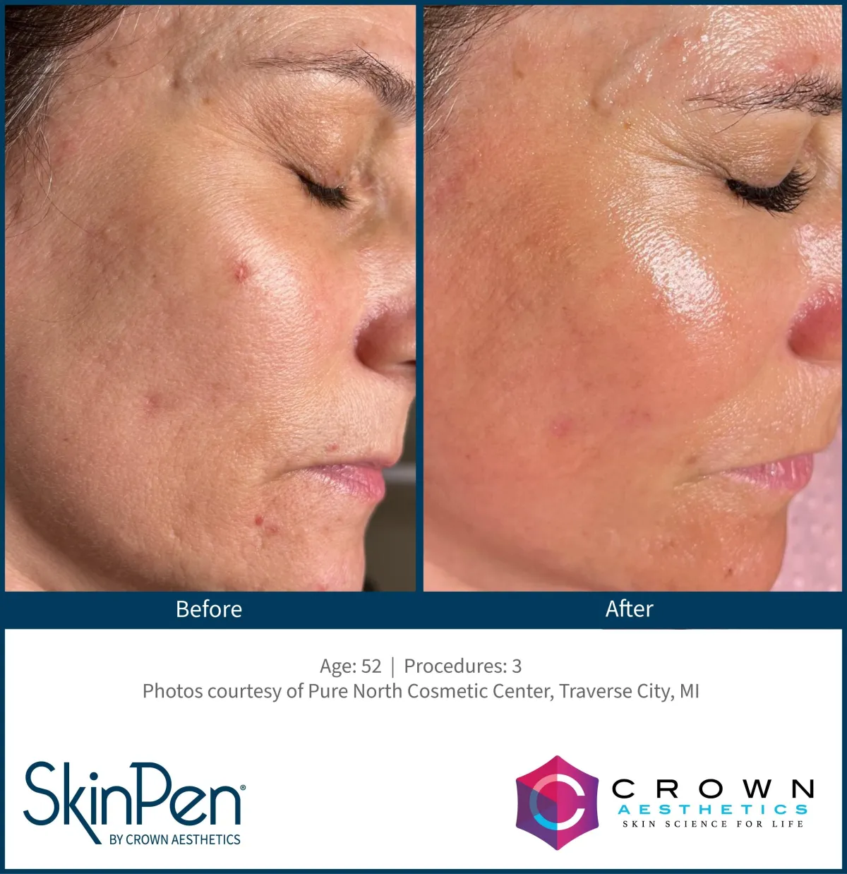 Skin Rejuvenation And Aesthetics