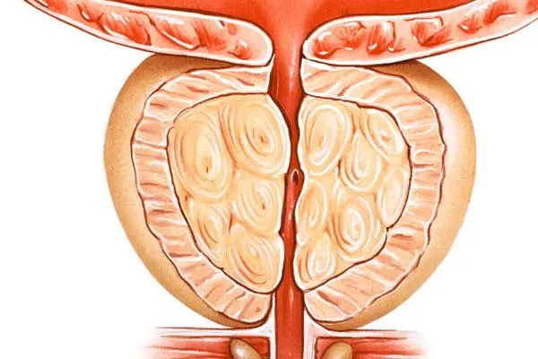 What Every Man Should Know About Long-Term Health