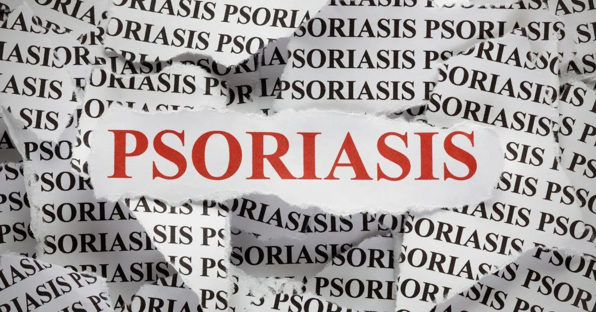 Aerolase for Psoriasis: Clearer Skin Without Harsh Treatments
