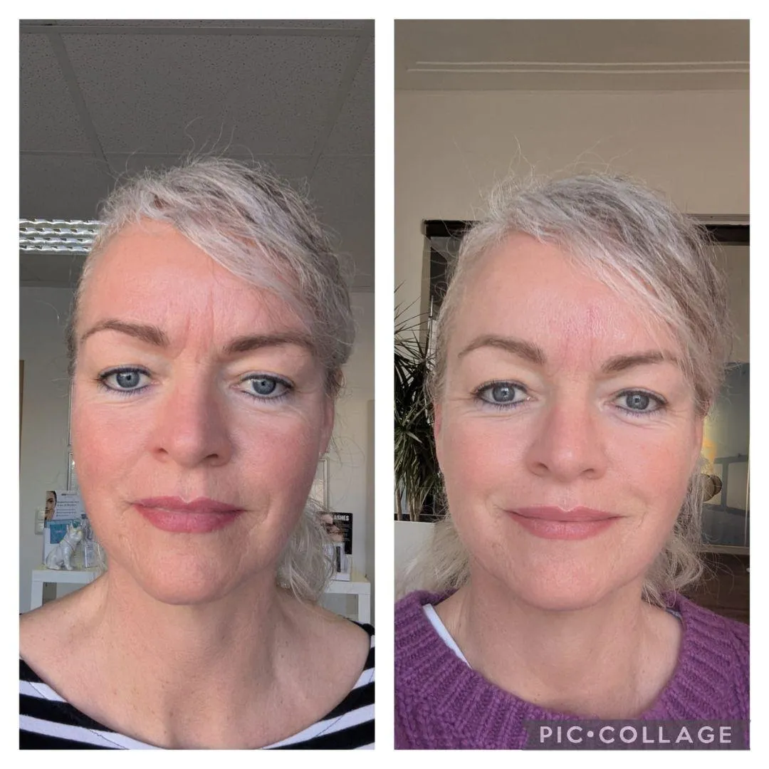 Ergebnis Gesichtsbehandlung Kosmetikstudio Feel Well Braunschweig