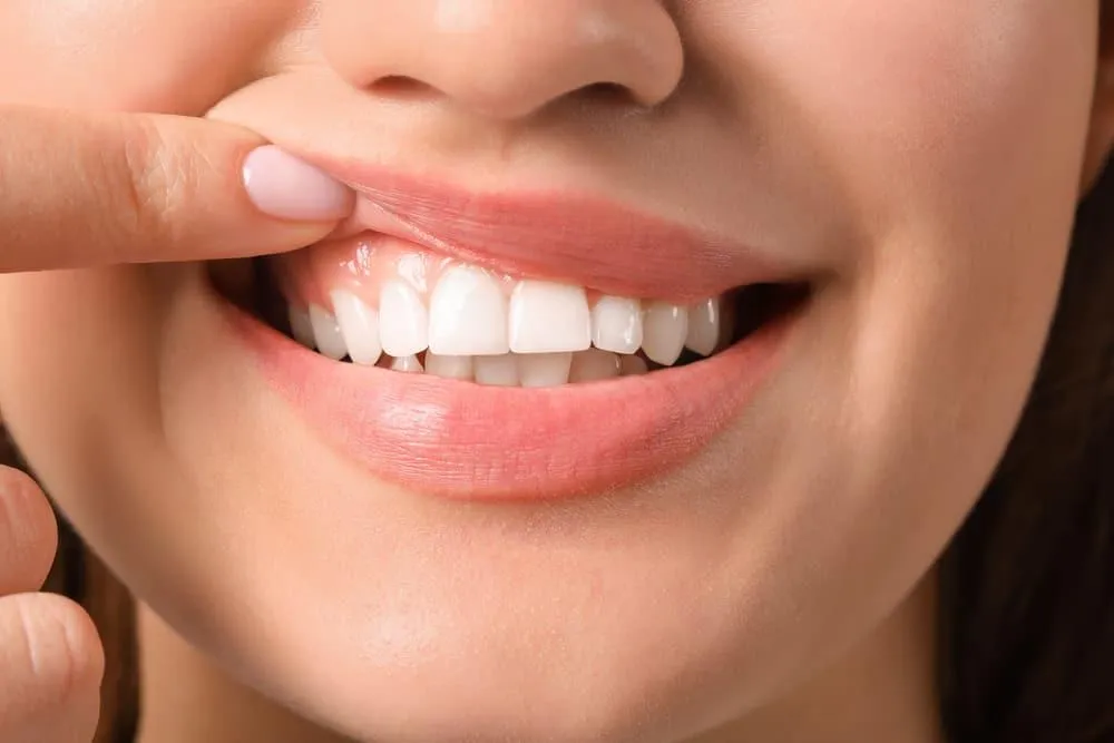Cosmetic Dentistry