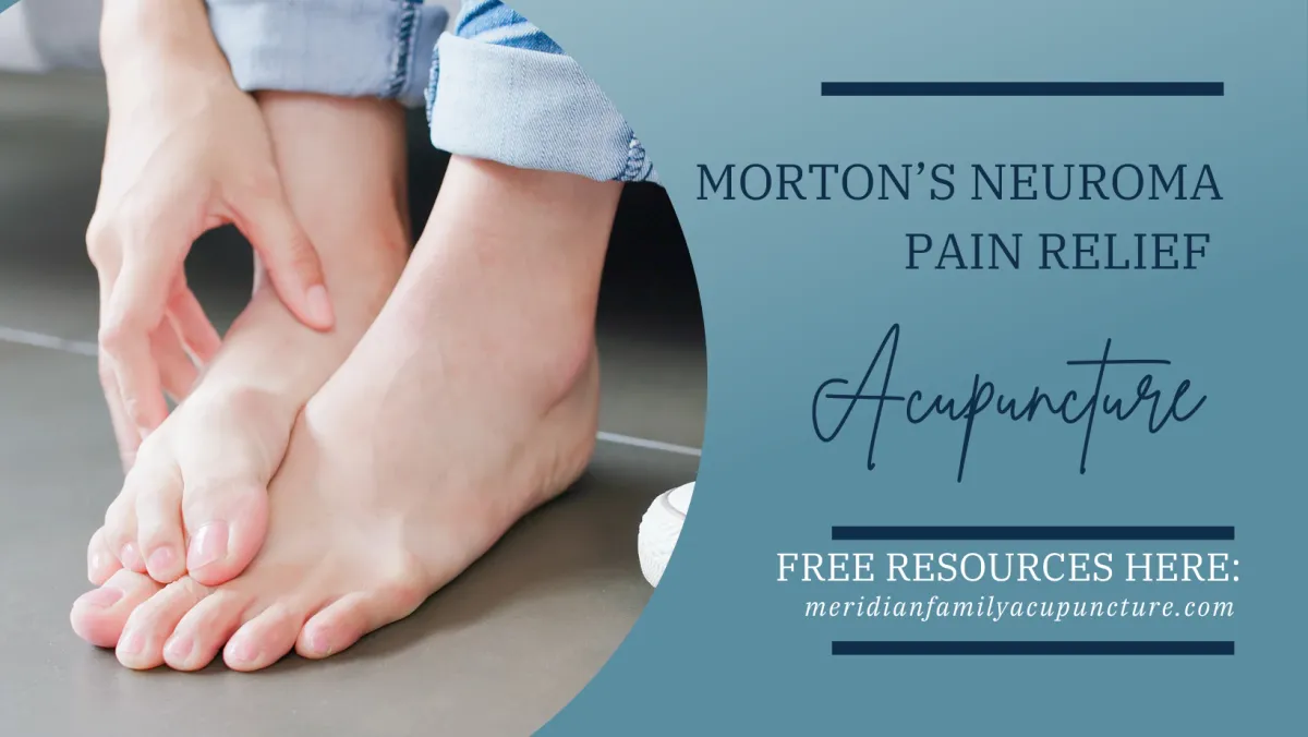 Non-Surgical Morton’s Neuroma Relief | Meridian Acupuncture