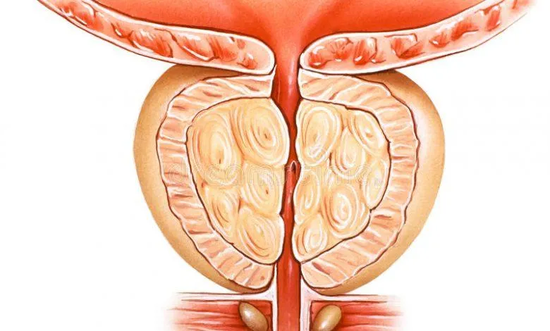 إجازة جهاز جديد لعلاج أعراض تضخم البروستات عند الرجال - الدكتور صالح بن صالح