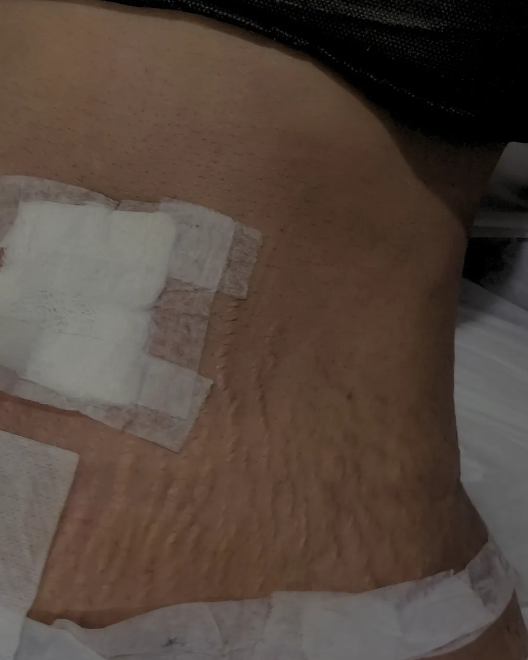 toronto post op lymphatic drainage massage training course