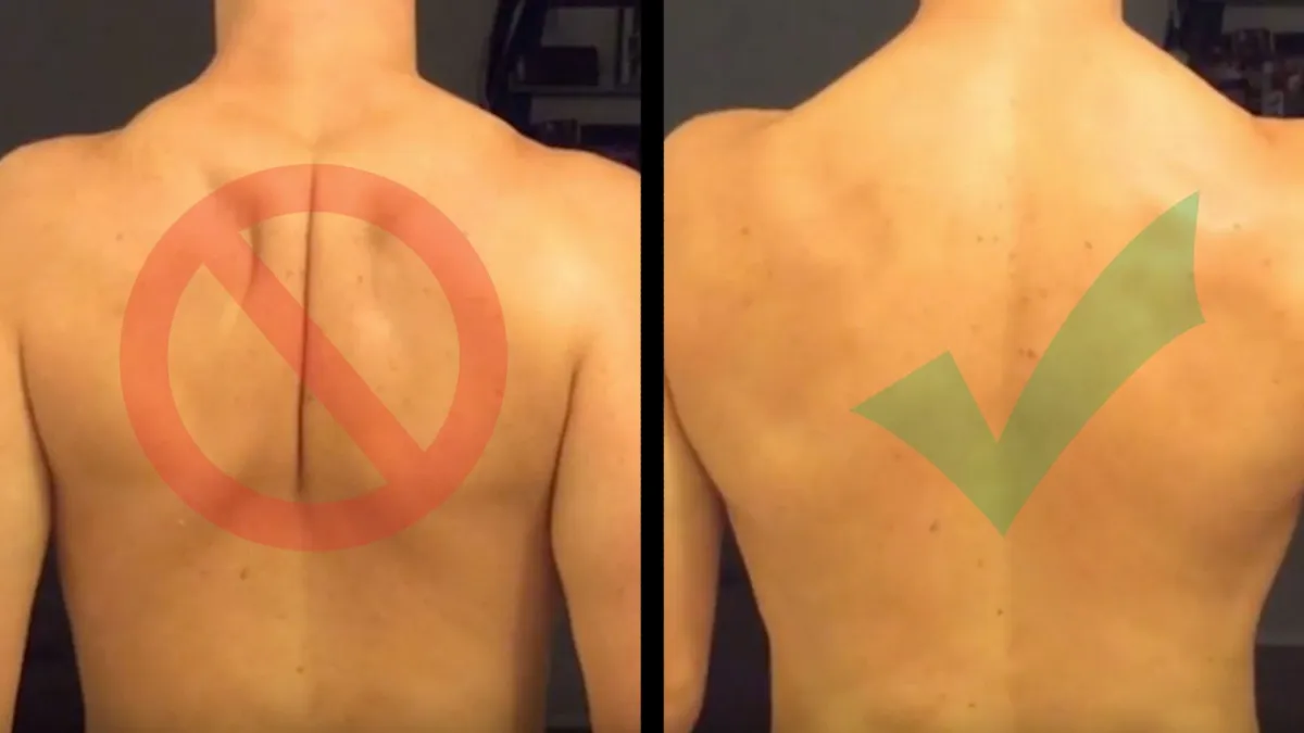Avoid These Common Arm Care Mistakes: Understanding Scapular Position