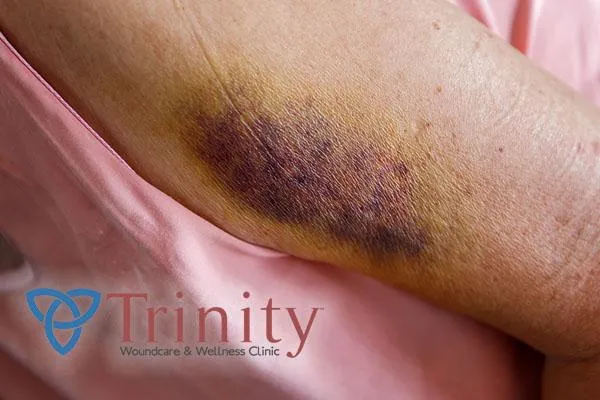 wound care clinic kansas city