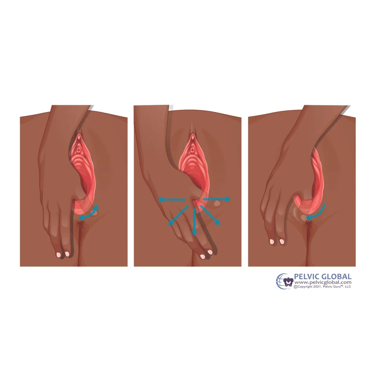 Tutorial of Perineal Massage