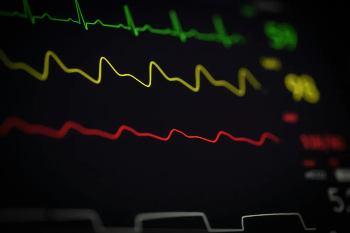 Medical monitor display with three wavy lines in green, yellow, and red colors on dark background representing cash flow vital signs
