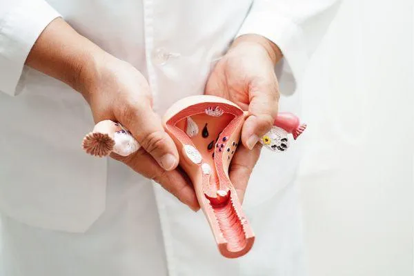 What is Cholesterol?