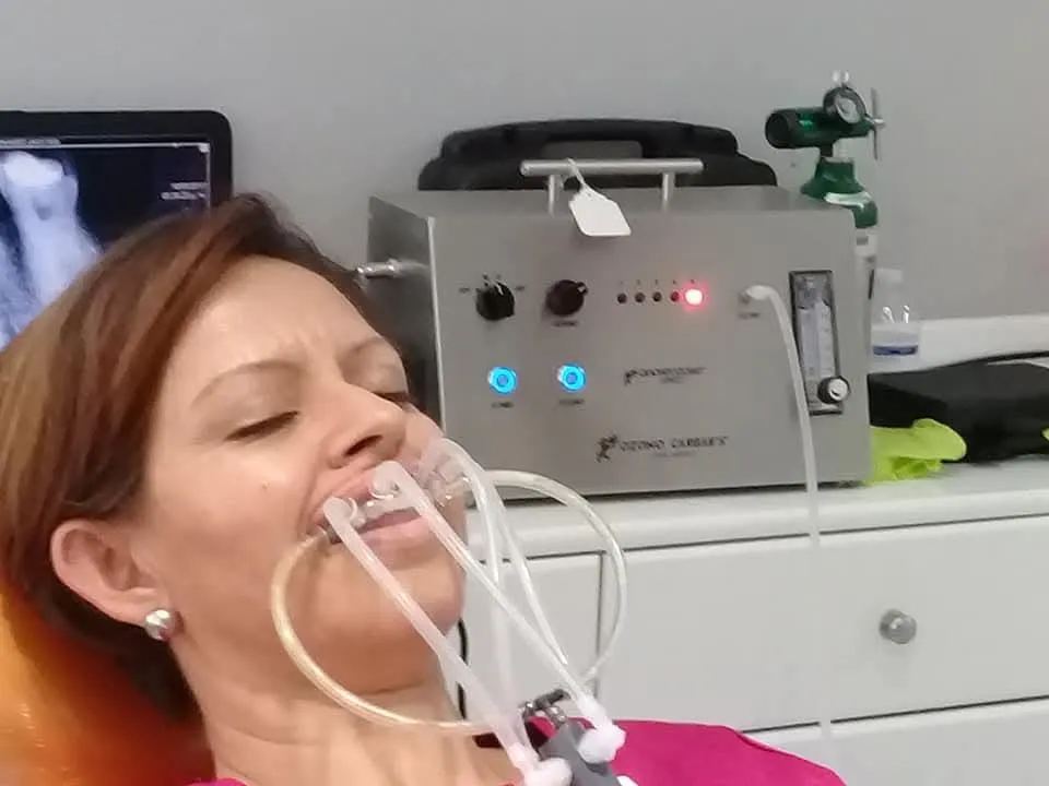 Aplicación de gas ozono con equipo Ozono Carbar's para blanqueamiento y desensibilización inmediata post-blanqueamiento dental.