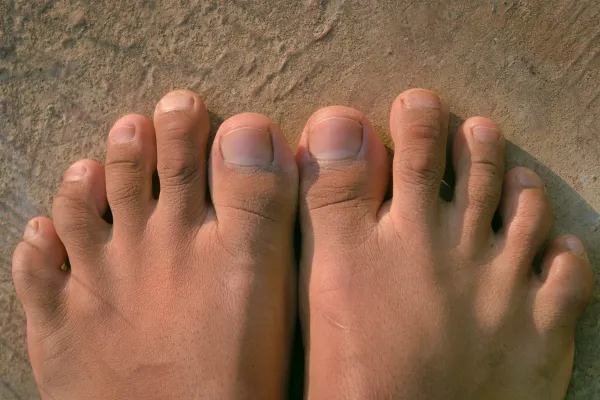 5 Things Your Toenails Say About Your Health