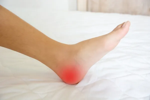 Plantar Fasciitis vs Heel Spurs: What’s Really Causing Your Foot Pain?