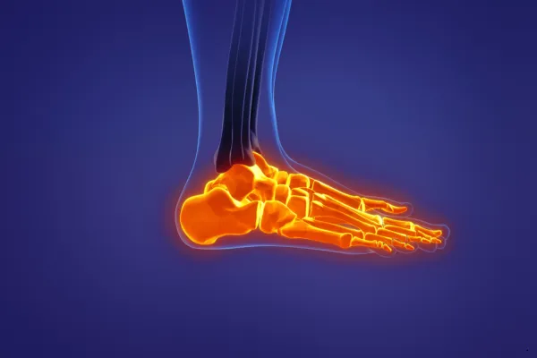 Cuboid Syndrome: The ‘Misbehaving’ Foot Bone You’ve Never Heard Of