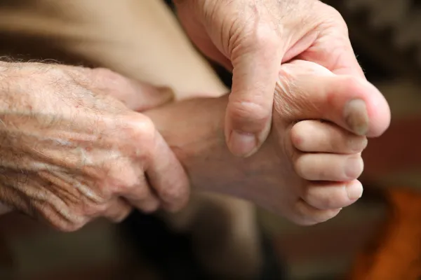 Toenail Trauma: What Happens If You Ignore a Bruise Under the Nail?
