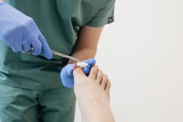 Is Nail Surgery as Scary as It Sounds? Let’s Clear That Up