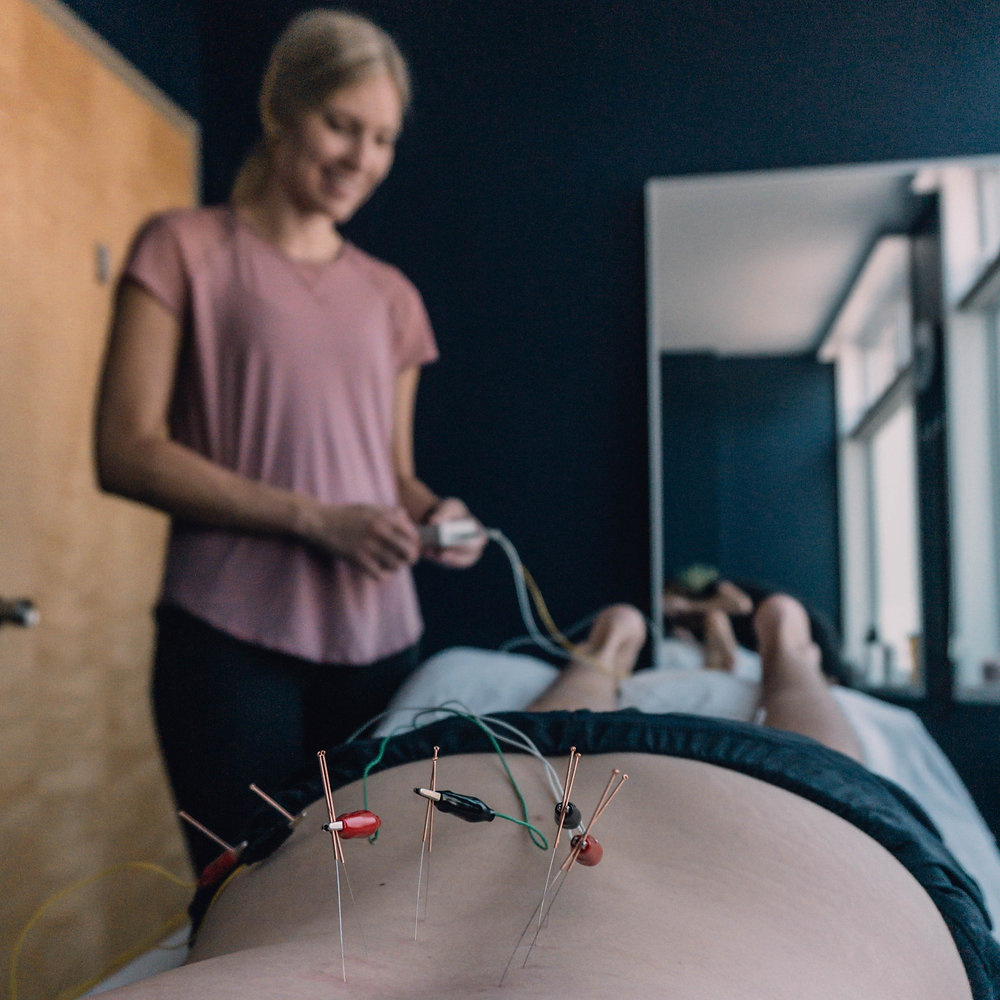 Neurofunctional Acupuncture: The Key to your Recovery and Optimal Performance